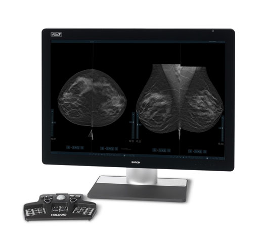 Tecnologia de aquisição de imagem 3DQuorum™ da Hologic em fundo branco
