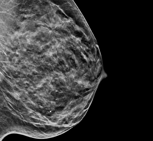 Sistema de imagem 2D sintetizada C-View™ da Hologic em fundo branco