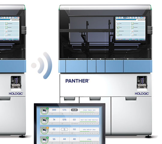 Imagem do Panther® Link da Hologic em fundo branco