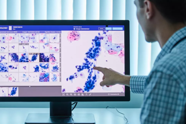 Profissional de saúde a analisar imagens de um exame num ecrã