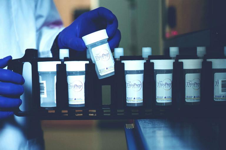 Pessoa com luva posta a recolher uma amostra do tabuleiro