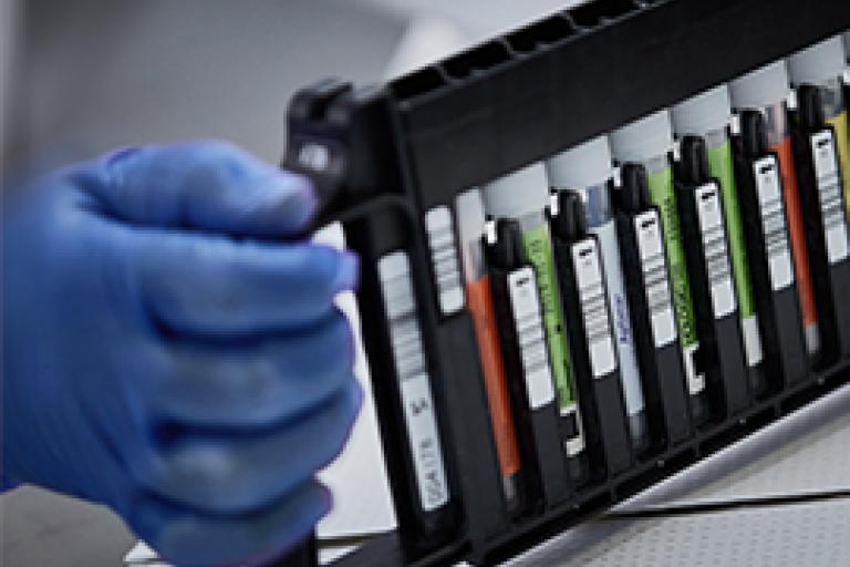 Pessoa com luva a segurar um suporte de frascos