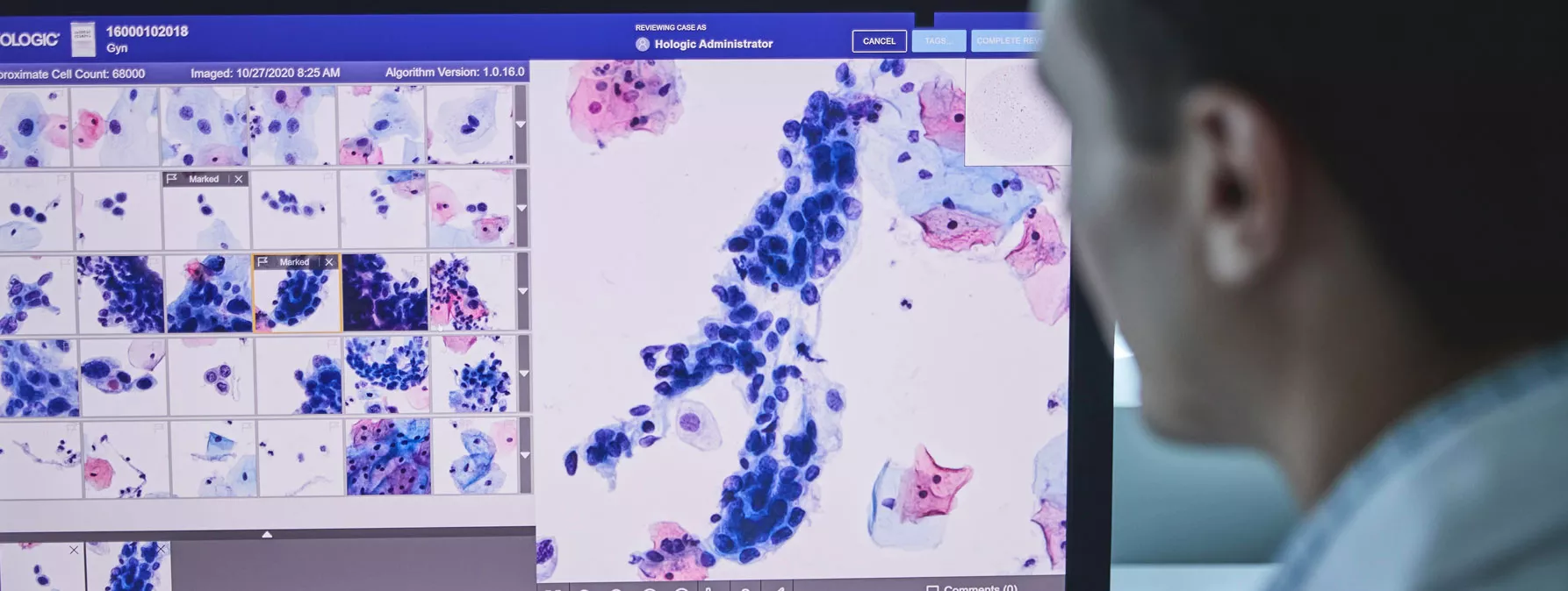 Imagem do sistema de diagnóstico digital Genius™