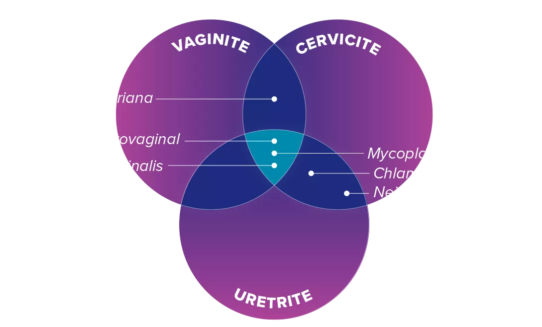 Ilustração sobreposta de Vaginite, Cervicite e Uretrite