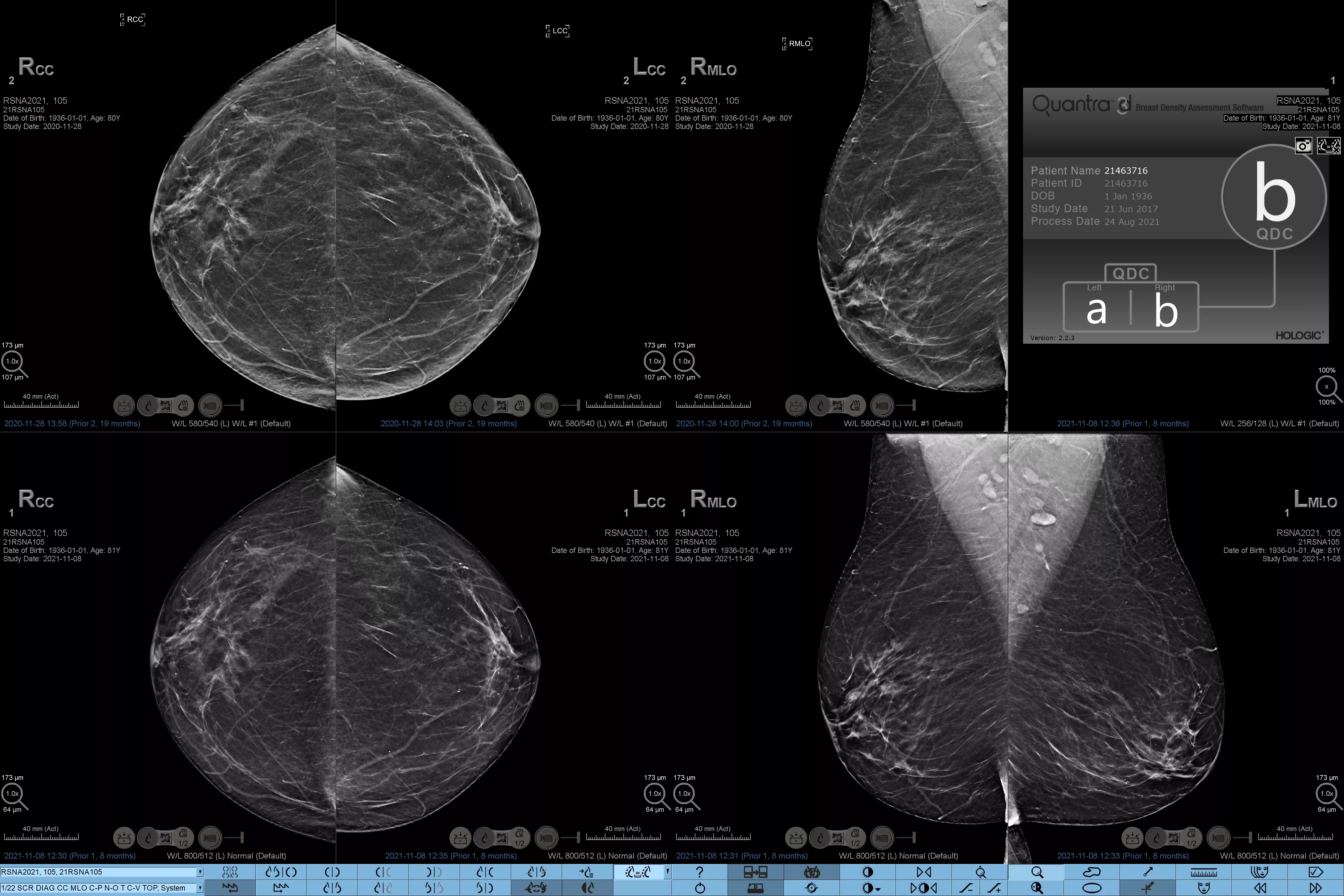 Transdutor-L18-5 em fundo branco