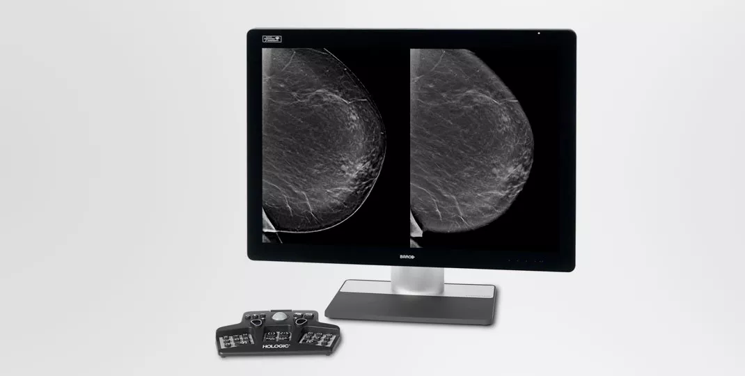 Imagem de mamografia