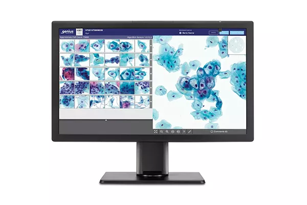 Estação de análise Genius em fundo branco