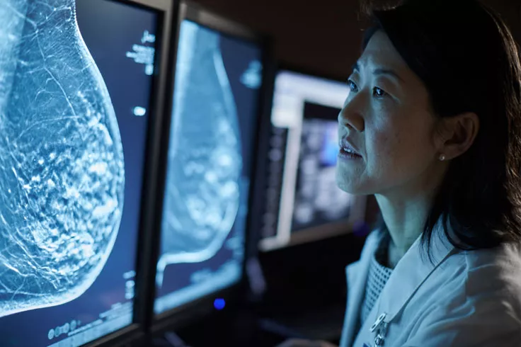 Profissional de saúde a analisar mamografias num monitor
