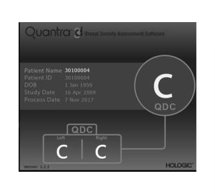 Tecnologia Quantra™ da Hologic em fundo branco